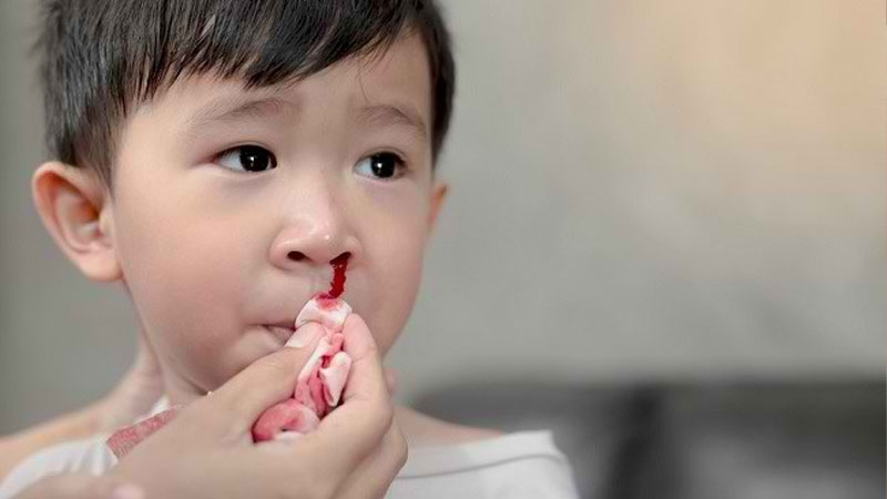 Cara Tepat Menangani Mimisan pada Anak – PAFI Kab. Kuantan Singingi